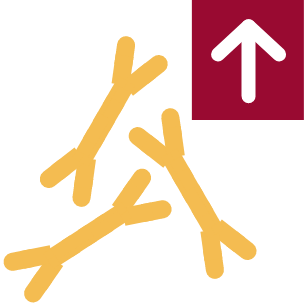 Illustration of the four disease markers in IgAN: Gd-IgA1, hematuria, proteinuria, and kidney function (eGFR)