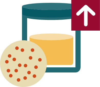 Illustration of the four disease markers in IgAN: Gd-IgA1, hematuria, proteinuria, and kidney function (eGFR)