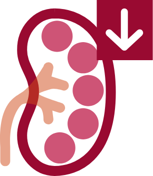 Illustration of the four disease markers in IgAN: Gd-IgA1, hematuria, proteinuria, and kidney function (eGFR)